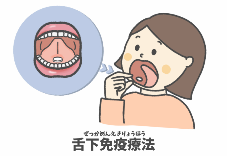 舌下免疫療法
