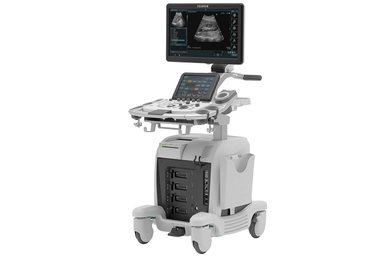 超音波診断装置